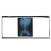 Negatoscopio triple de 3 pantallas Mod. Avante Cat. CIS-6320 Ciiasa