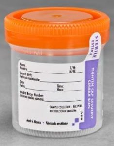 Vaso Recolector Esteril con Termometro